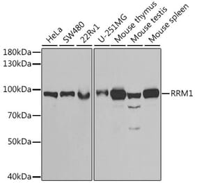 Western Blot - Anti-RRM1 Antibody (A91462) - Antibodies.com