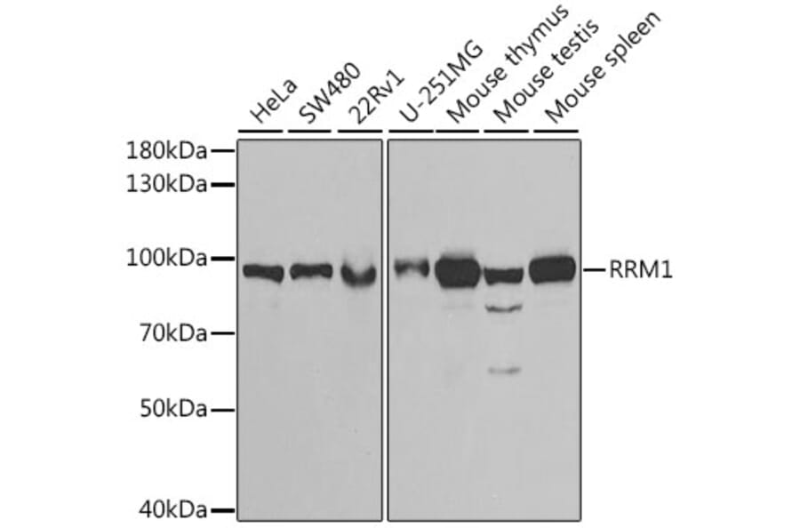 Western Blot - Anti-RRM1 Antibody (A91462) - Antibodies.com