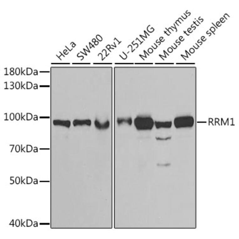 Western Blot - Anti-RRM1 Antibody (A91462) - Antibodies.com
