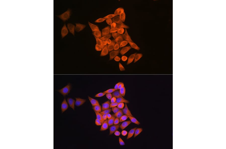 Immunofluorescence - Anti-RRM1 Antibody (A91462) - Antibodies.com