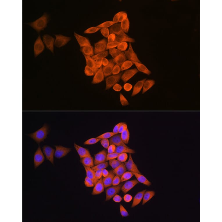 Immunofluorescence - Anti-RRM1 Antibody (A91462) - Antibodies.com