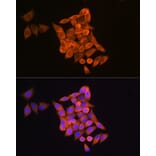 Immunofluorescence - Anti-RRM1 Antibody (A91462) - Antibodies.com