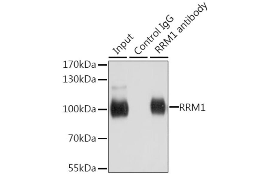Western Blot - Anti-RRM1 Antibody (A91462) - Antibodies.com