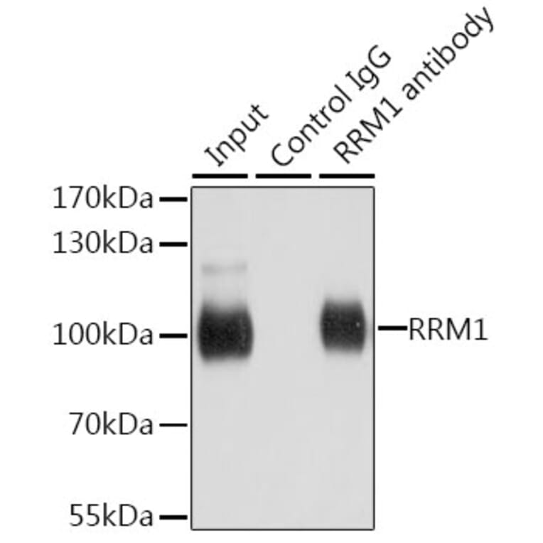 Western Blot - Anti-RRM1 Antibody (A91462) - Antibodies.com
