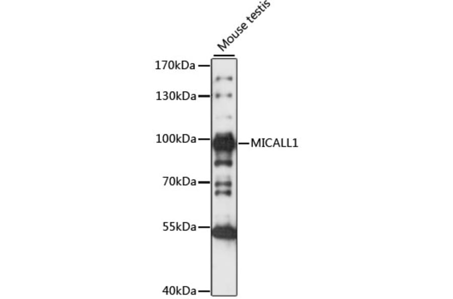 Western Blot - Anti-MICALL1 Antibody (A91463) - Antibodies.com