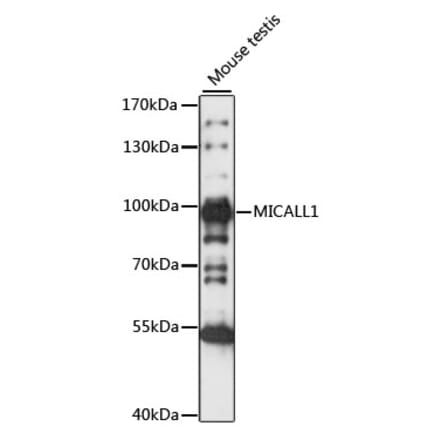 Western Blot - Anti-MICALL1 Antibody (A91463) - Antibodies.com