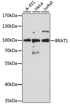 Western blot analysis of extracts of various cell lines, using Anti-BRAT1 Antibody (A12801) at 1:3000 dilution.
Secondary antibody: Goat Anti-Rabbit IgG (H+L) (HRP) (AS014) at 1:10,000 dilution.
Lysates / proteins: 25µg per lane.
Blocking buffer: 3% non-fat dry milk in TBST.
Detection: ECL Basic Kit (RM00020).
Exposure time: 30s.