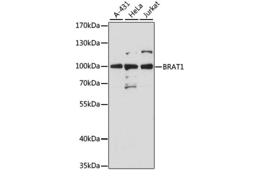 Western Blot - Anti-BRAT1 Antibody (A91464) - Antibodies.com