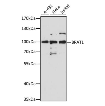 Western Blot - Anti-BRAT1 Antibody (A91464) - Antibodies.com