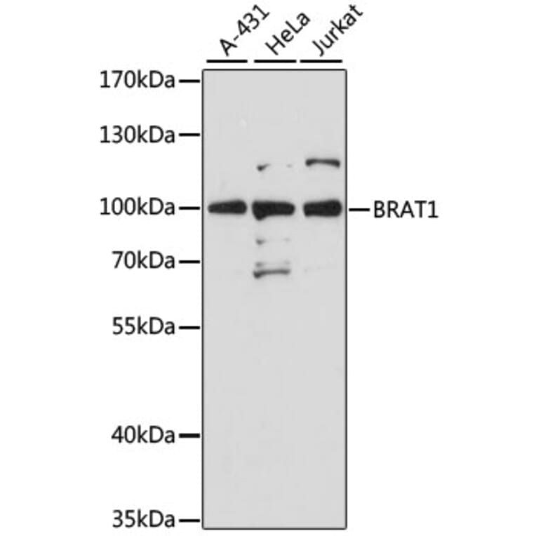 Western Blot - Anti-BRAT1 Antibody (A91464) - Antibodies.com
