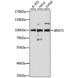 Western Blot - Anti-BRAT1 Antibody (A91464) - Antibodies.com