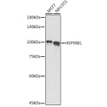 Western Blot - Anti-GRP94 Antibody (A91465) - Antibodies.com