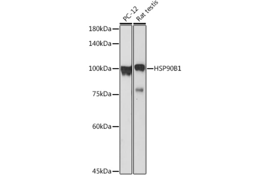 Western Blot - Anti-GRP94 Antibody (A91465) - Antibodies.com