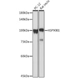 Western Blot - Anti-GRP94 Antibody (A91465) - Antibodies.com