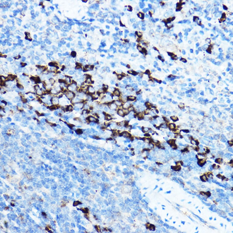 Immunohistochemistry - Anti-GRP94 Antibody (A91465) - Antibodies.com