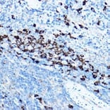 Immunohistochemistry - Anti-GRP94 Antibody (A91465) - Antibodies.com