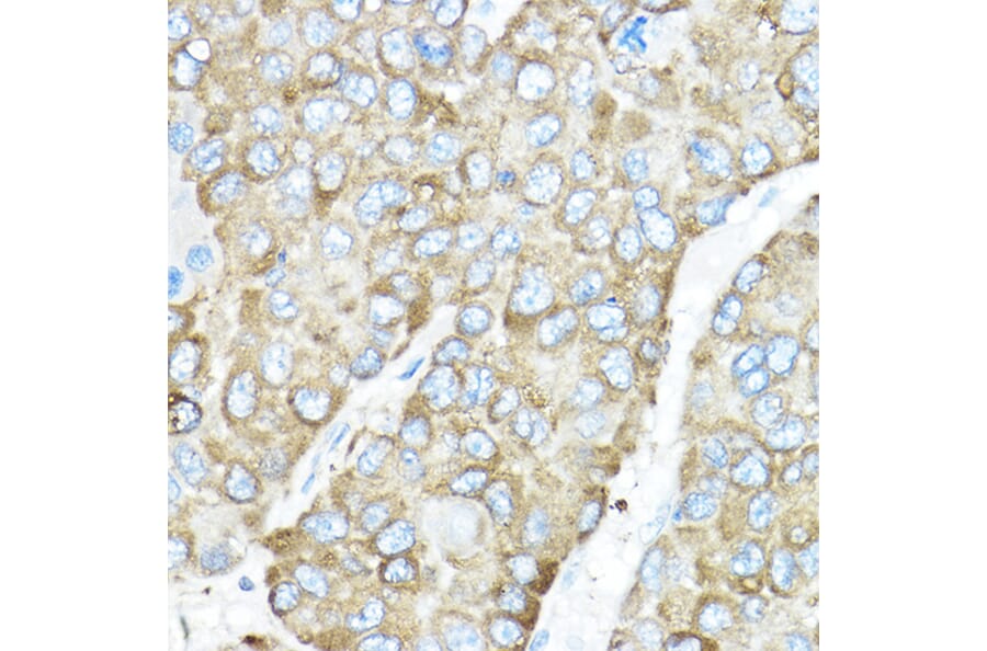 Immunohistochemistry - Anti-GRP94 Antibody (A91465) - Antibodies.com