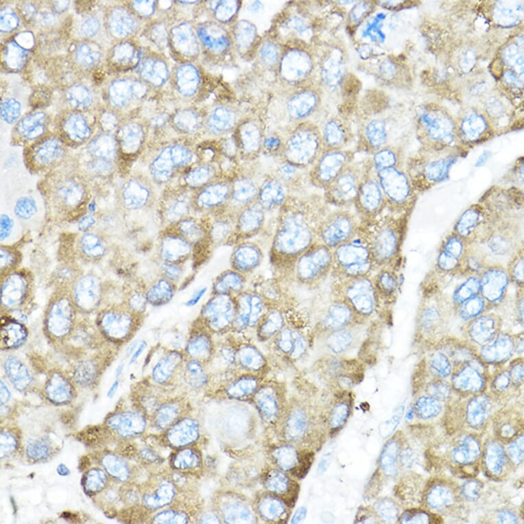 Immunohistochemistry - Anti-GRP94 Antibody (A91465) - Antibodies.com