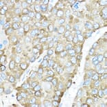 Immunohistochemistry - Anti-GRP94 Antibody (A91465) - Antibodies.com