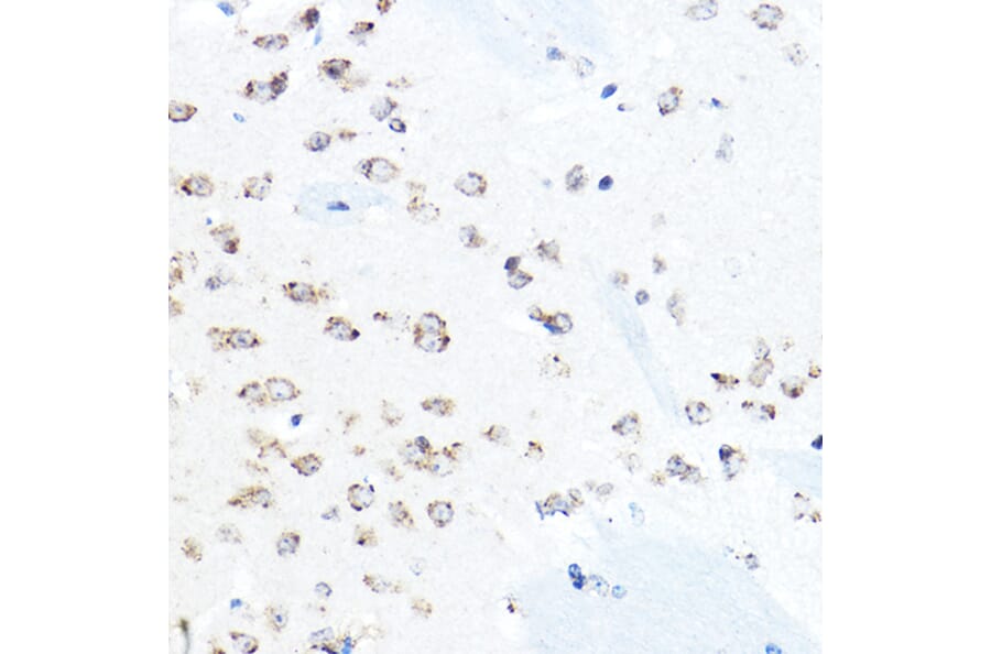 Immunohistochemistry - Anti-GRP94 Antibody (A91465) - Antibodies.com