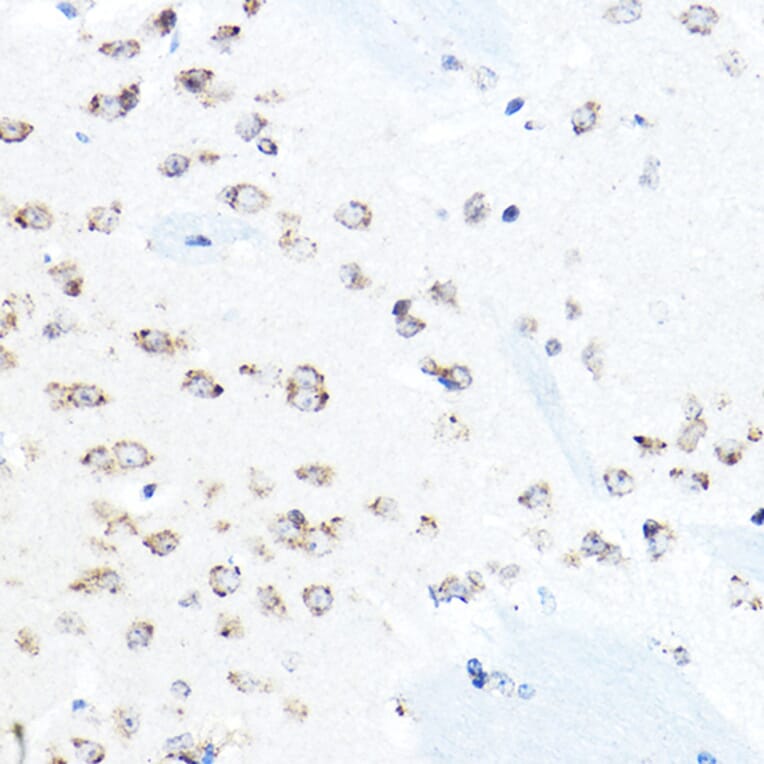 Immunohistochemistry - Anti-GRP94 Antibody (A91465) - Antibodies.com