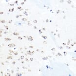 Immunohistochemistry - Anti-GRP94 Antibody (A91465) - Antibodies.com