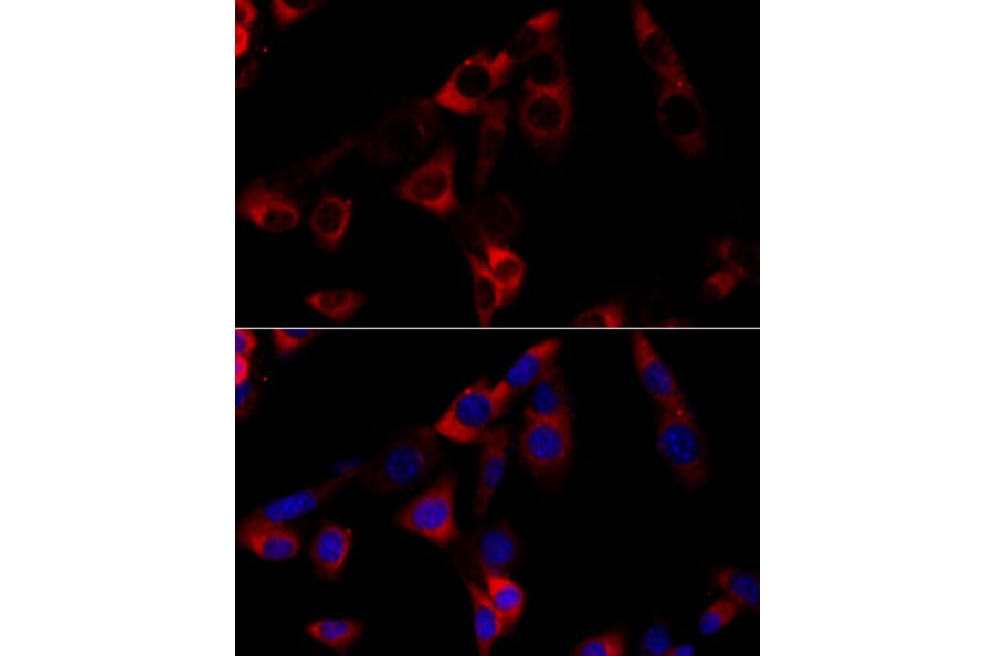 Immunofluorescence - Anti-GRP94 Antibody (A91465) - Antibodies.com