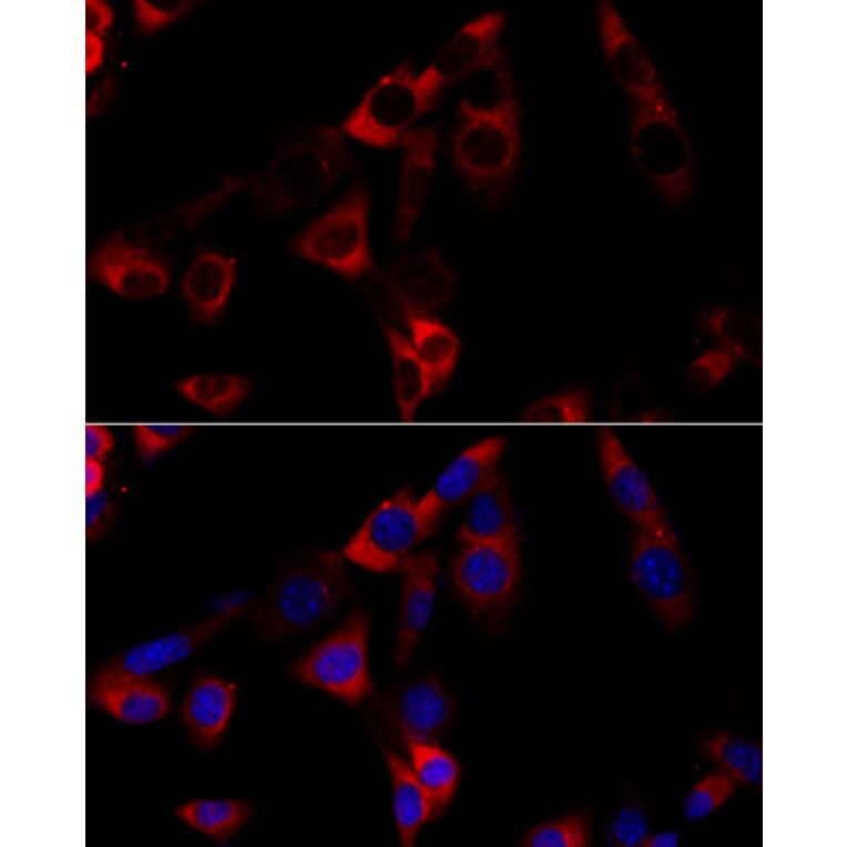 Immunofluorescence - Anti-GRP94 Antibody (A91465) - Antibodies.com