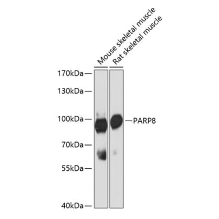 Western Blot - Anti-PARP8 Antibody (A91466) - Antibodies.com