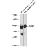 Western Blot - Anti-PARP8 Antibody (A91466) - Antibodies.com