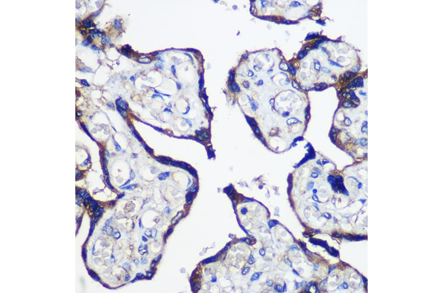 Immunohistochemistry - Anti-PARP8 Antibody (A91466) - Antibodies.com