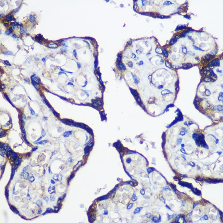 Immunohistochemistry - Anti-PARP8 Antibody (A91466) - Antibodies.com