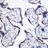 Immunohistochemistry - Anti-PARP8 Antibody (A91466) - Antibodies.com