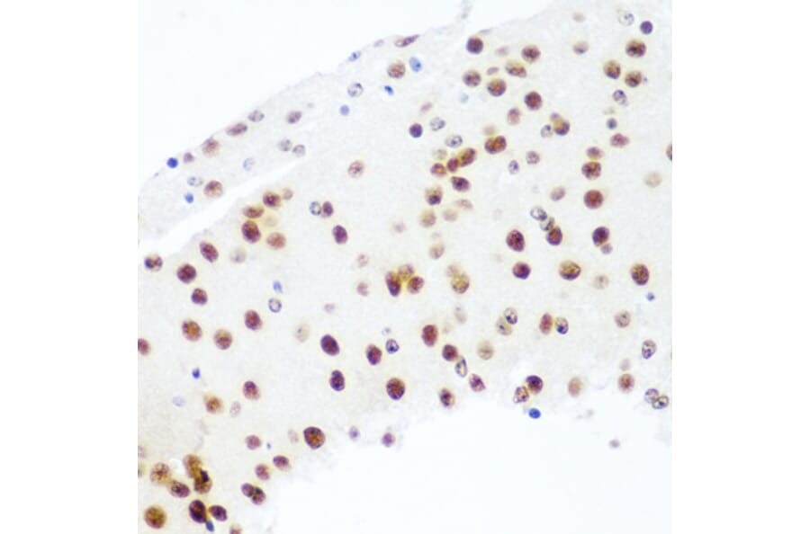 Immunohistochemistry - Anti-Argonaute-2 Antibody (A91467) - Antibodies.com