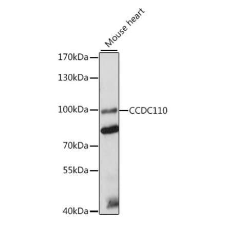 Western Blot - Anti-CCDC110 Antibody (A91468) - Antibodies.com