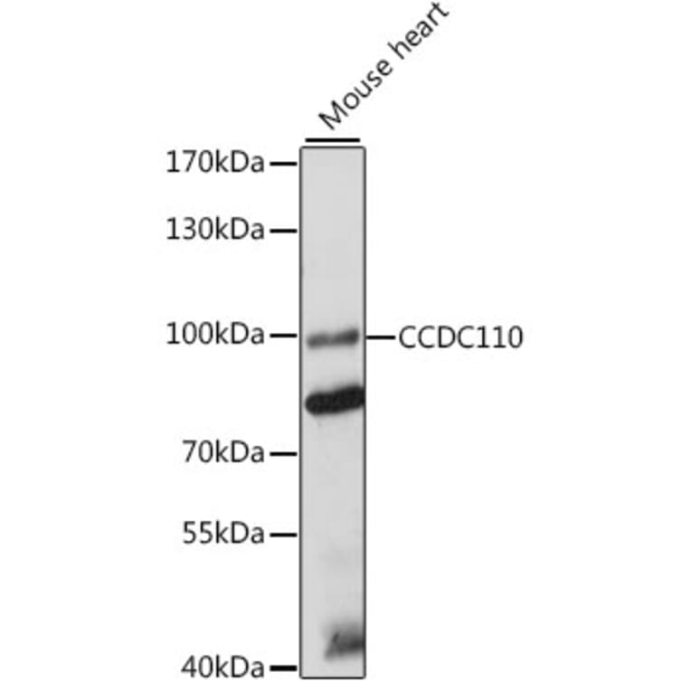 Western Blot - Anti-CCDC110 Antibody (A91468) - Antibodies.com