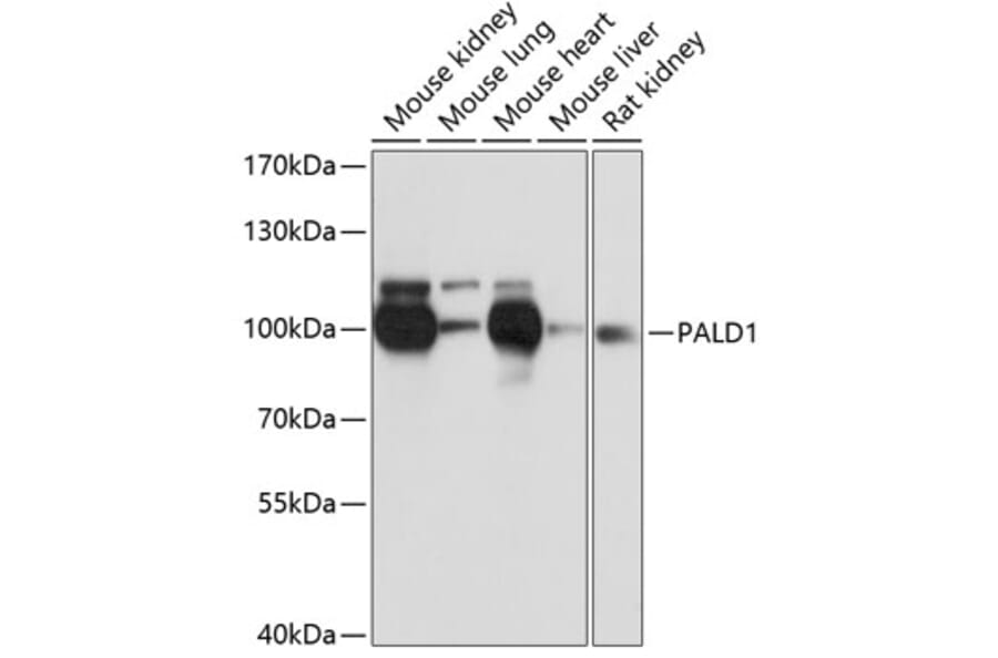 Western Blot - Anti-PALD1 Antibody (A91469) - Antibodies.com
