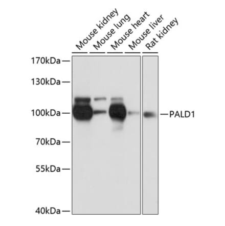 Western Blot - Anti-PALD1 Antibody (A91469) - Antibodies.com