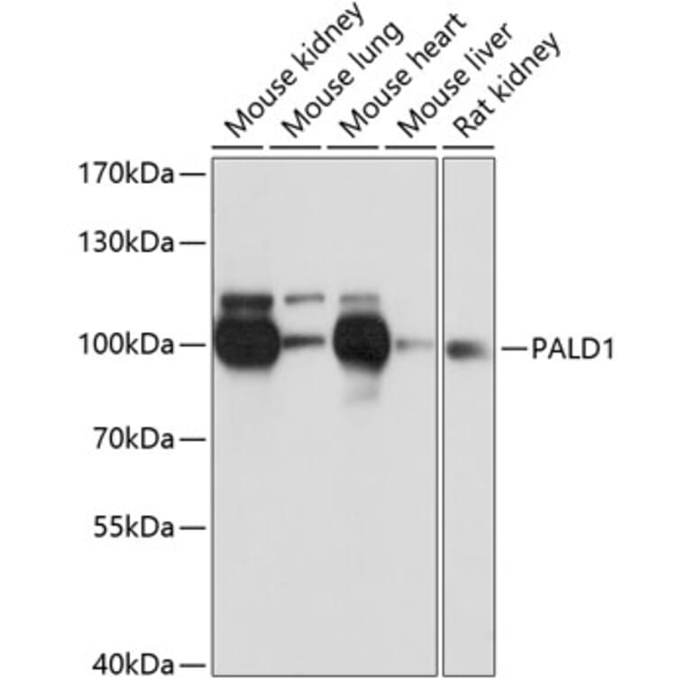 Western Blot - Anti-PALD1 Antibody (A91469) - Antibodies.com