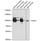 Western Blot - Anti-PALD1 Antibody (A91469) - Antibodies.com