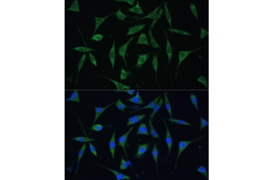 Immunofluorescence - Anti-PALD1 Antibody (A91469) - Antibodies.com