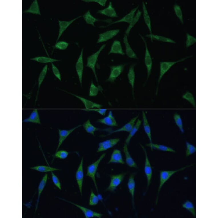 Immunofluorescence - Anti-PALD1 Antibody (A91469) - Antibodies.com