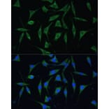 Immunofluorescence - Anti-PALD1 Antibody (A91469) - Antibodies.com
