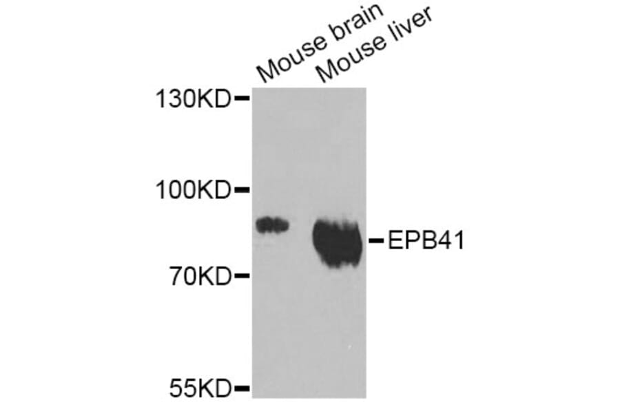 Western Blot - Anti-EPB41 Antibody (A12434) - Antibodies.com