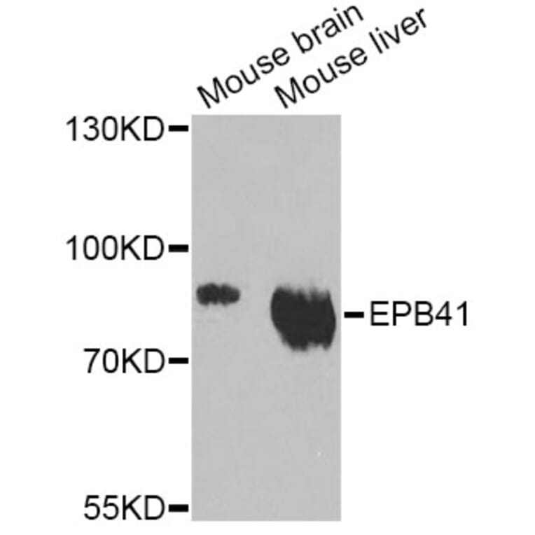 Western Blot - Anti-EPB41 Antibody (A12434) - Antibodies.com