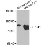 Western Blot - Anti-EPB41 Antibody (A12434) - Antibodies.com