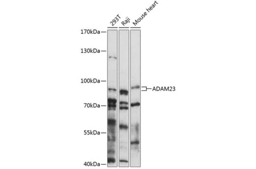 Western Blot - Anti-ADAM23 Antibody (A91471) - Antibodies.com