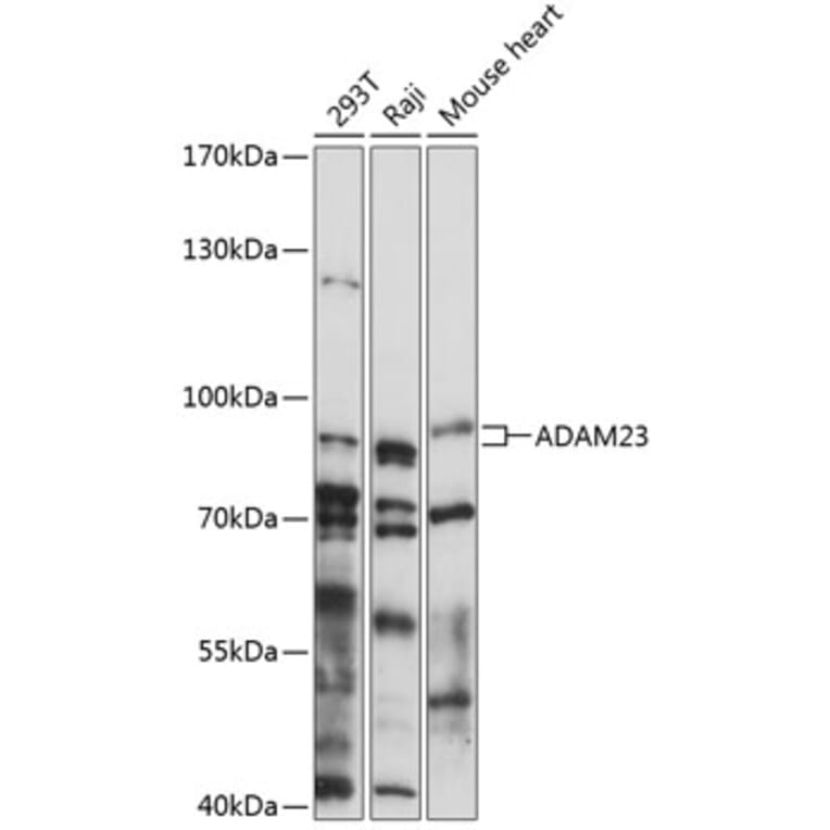 Western Blot - Anti-ADAM23 Antibody (A91471) - Antibodies.com