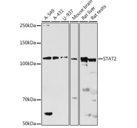 Western Blot - Anti-STAT2 Antibody (A91472) - Antibodies.com