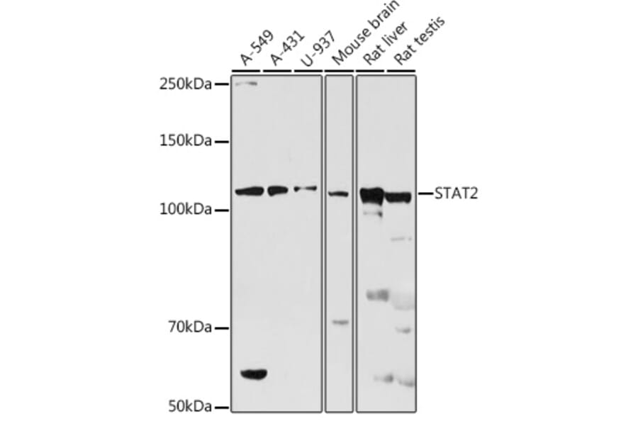 Western Blot - Anti-STAT2 Antibody (A91472) - Antibodies.com